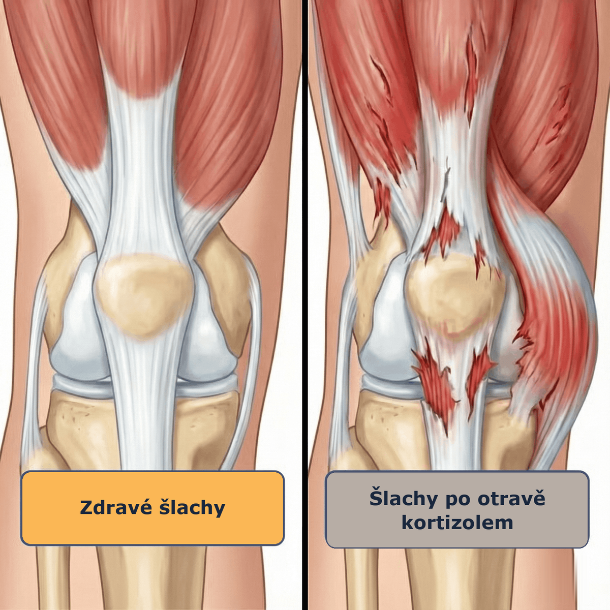 cx-knee-cs